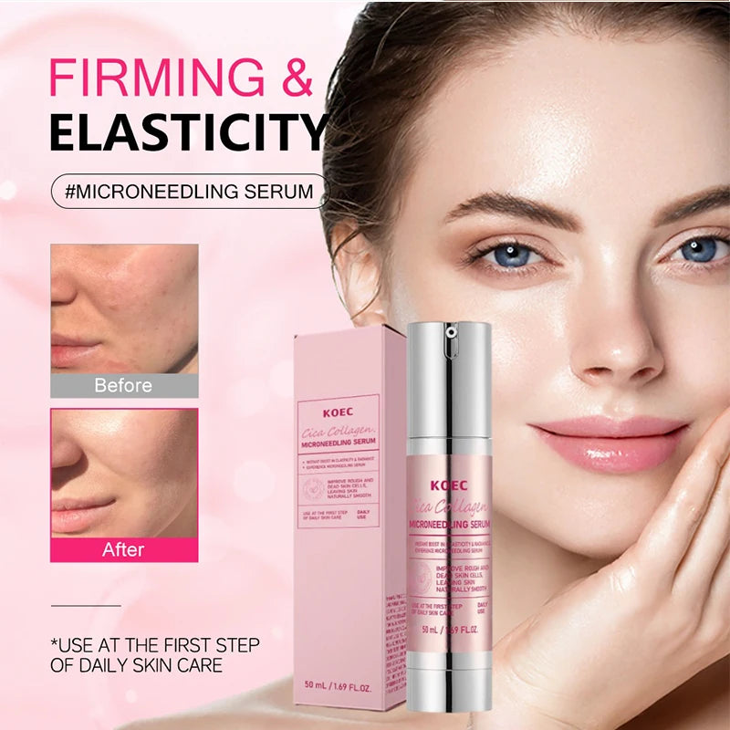 🌟 SIERO RIGENERANTE VITAMIN C + CENTELLA ASIATICA - Post-Microneedling Specialist