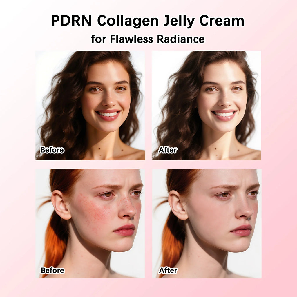 Crema Viso Jelly al PDRN & Collagene Coreano