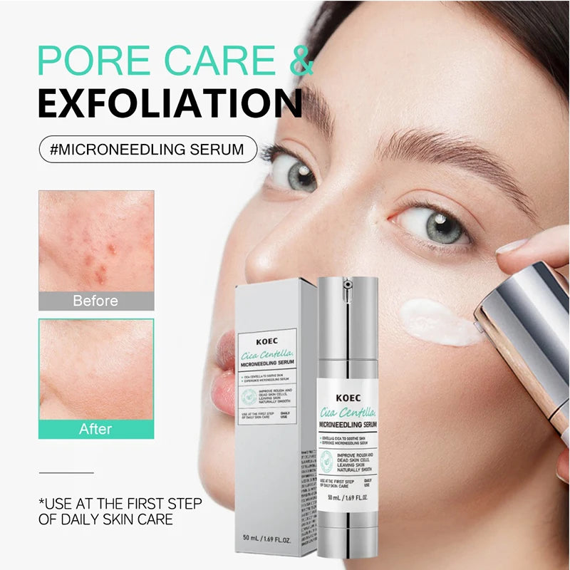 🌟 SIERO RIGENERANTE VITAMIN C + CENTELLA ASIATICA - Post-Microneedling Specialist