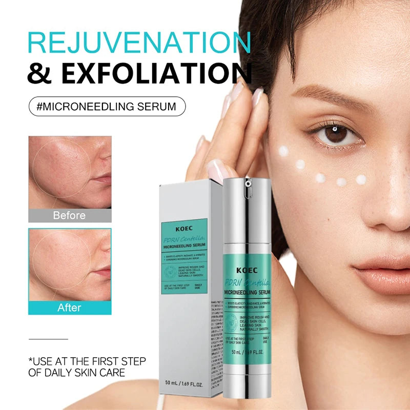 🌟 SIERO RIGENERANTE VITAMIN C + CENTELLA ASIATICA - Post-Microneedling Specialist