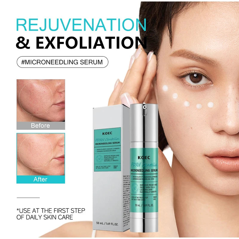 🌟 SIERO RIGENERANTE VITAMIN C + CENTELLA ASIATICA - Post-Microneedling Specialist